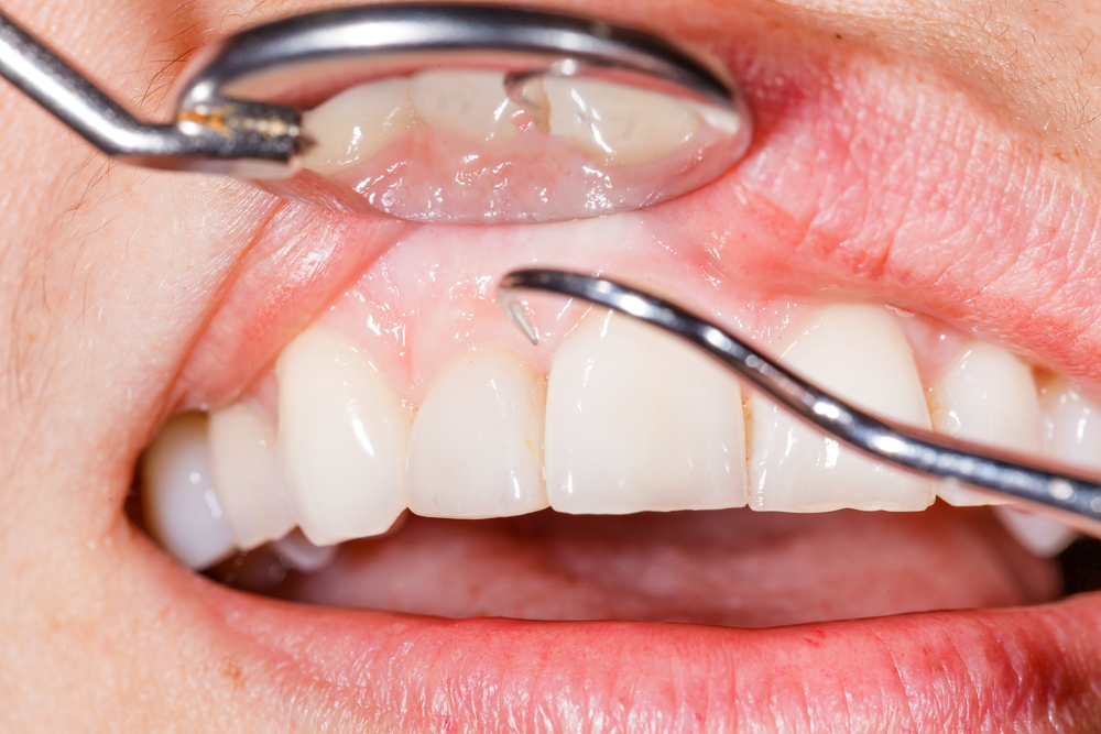 Tips For Encouraging Good Oral Hygiene Habits At Home