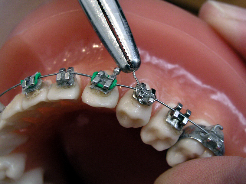 Managing Orthodontic Needs Within The Family Practice
