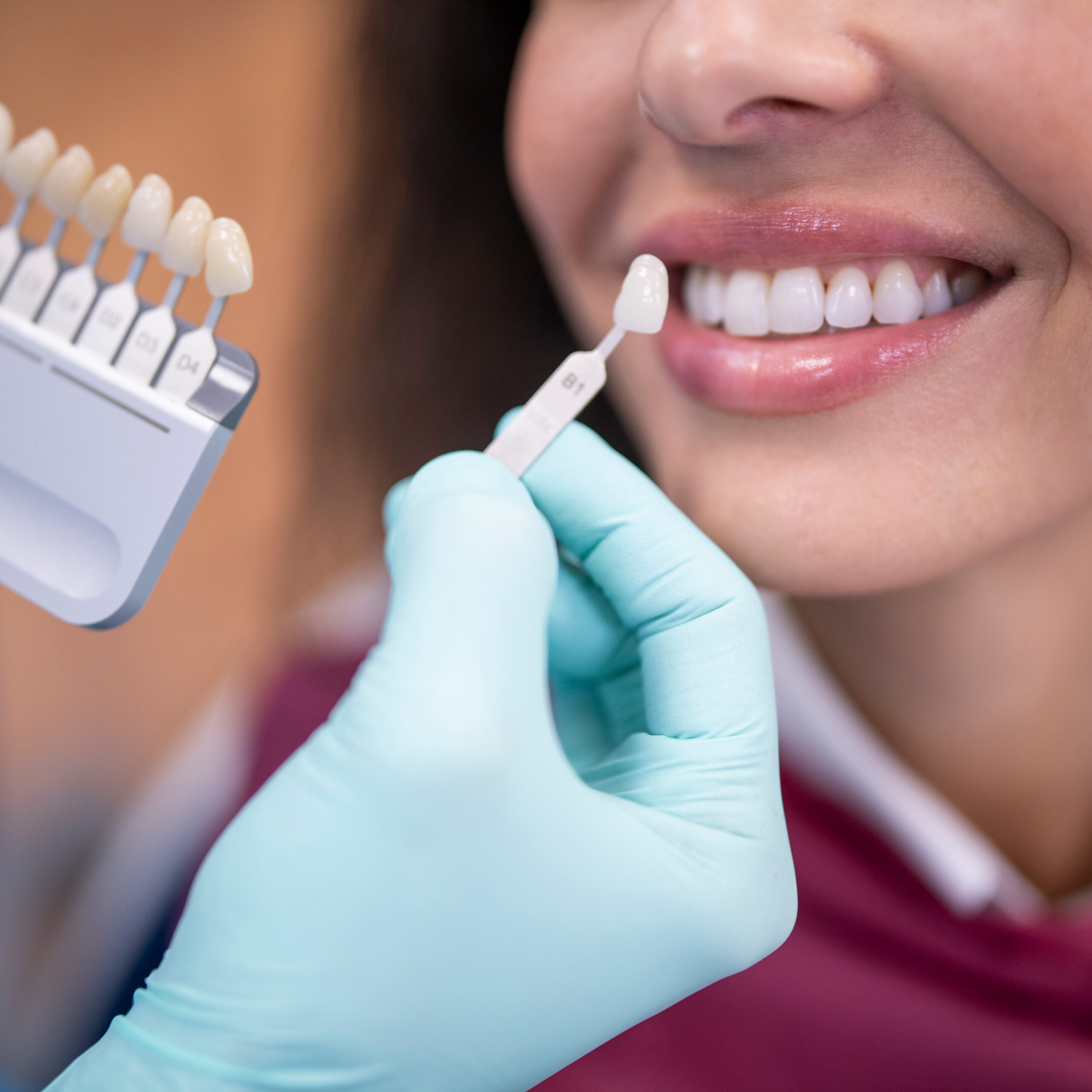 How Family and Cosmetic Dentistry Work Together for Complete Care
