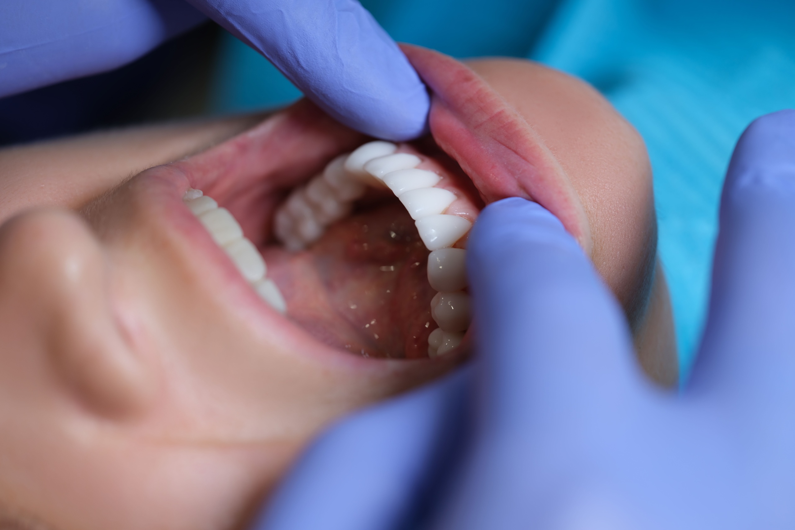 How Cosmetic Dentistry Supports Long Term Oral Wellness