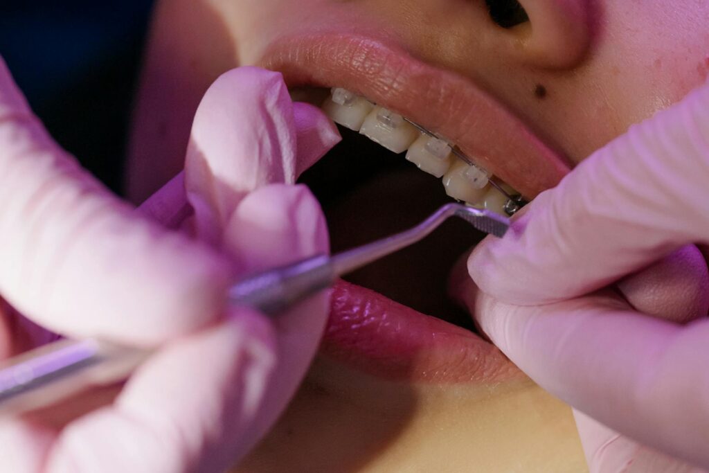 What Your Chewing Patterns Reveal During A General Exam