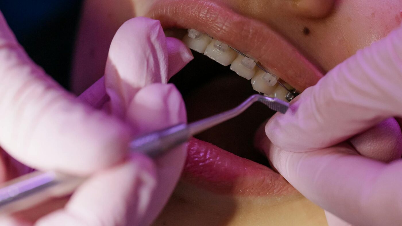 What Your Chewing Patterns Reveal During A General Exam