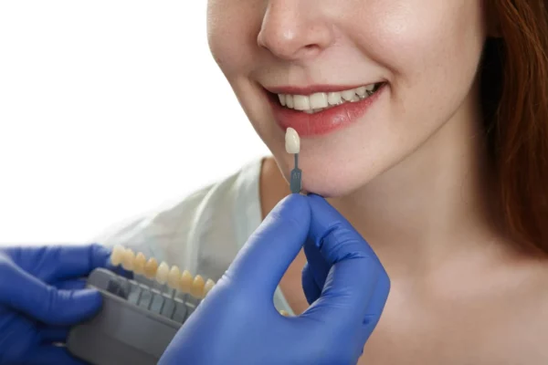 The Role Of Cosmetic Bonding In Subtle Smile Enhancements