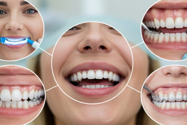 5 Ways General And Cosmetic Dentistry Work Together For A Complete Smile