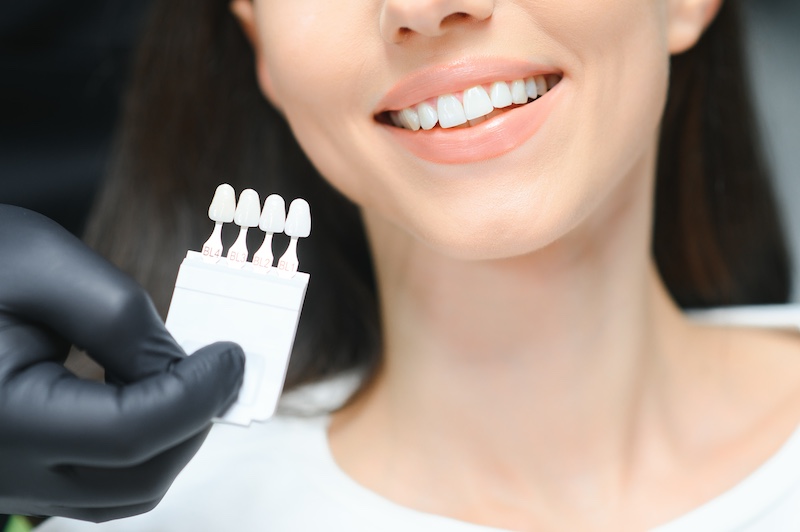 3 Cosmetic Dentistry Enhancements That Can Be Completed Quickly