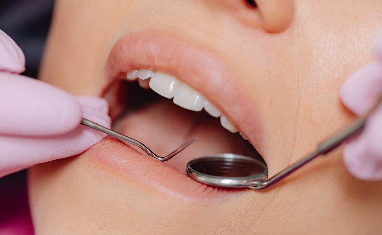 5 Preventive Treatments That Support Smiles At Every Life Stage