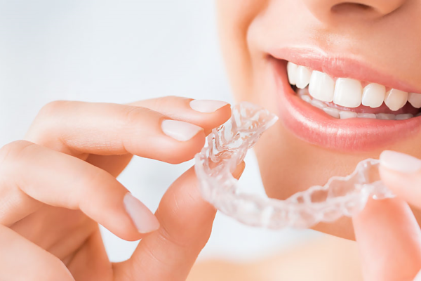 5 Benefits Of Choosing Clear Aligners For Smile Correction