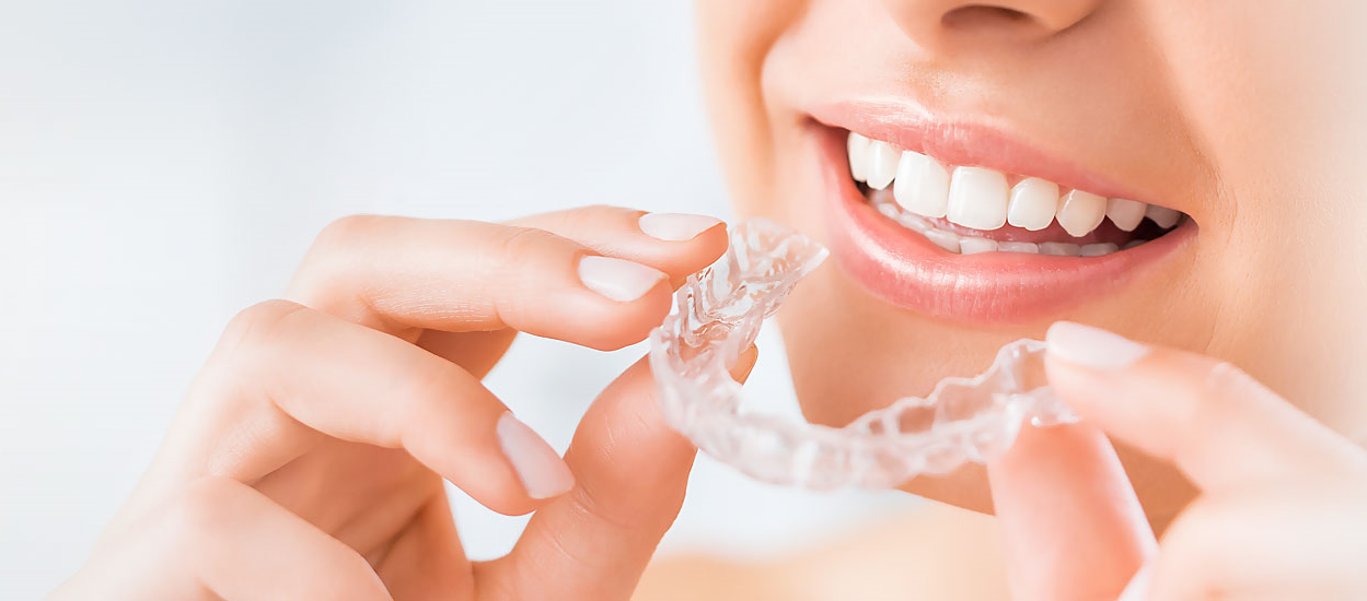 5 Benefits Of Choosing Clear Aligners For Smile Correction